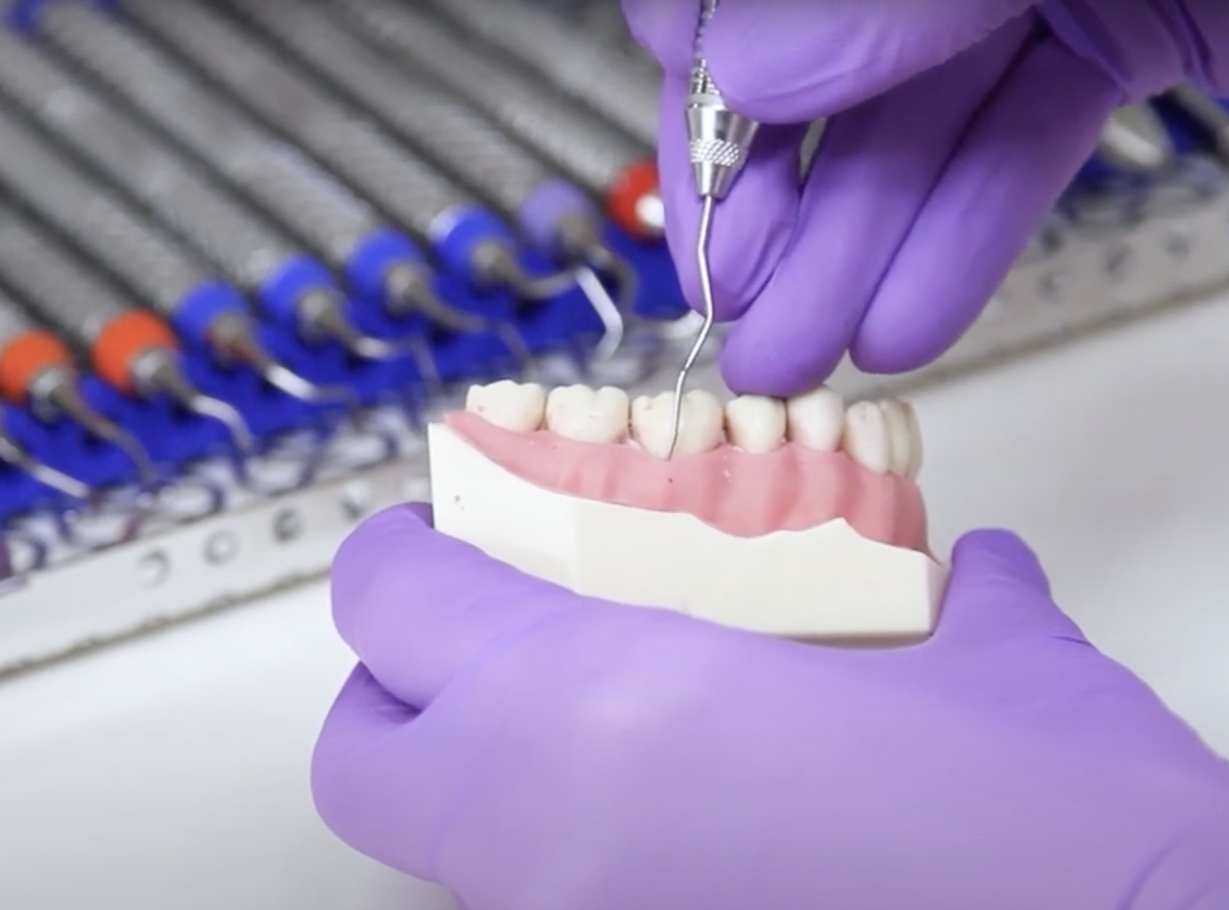 KONTROLLE DER PARODONTALTASCHEN