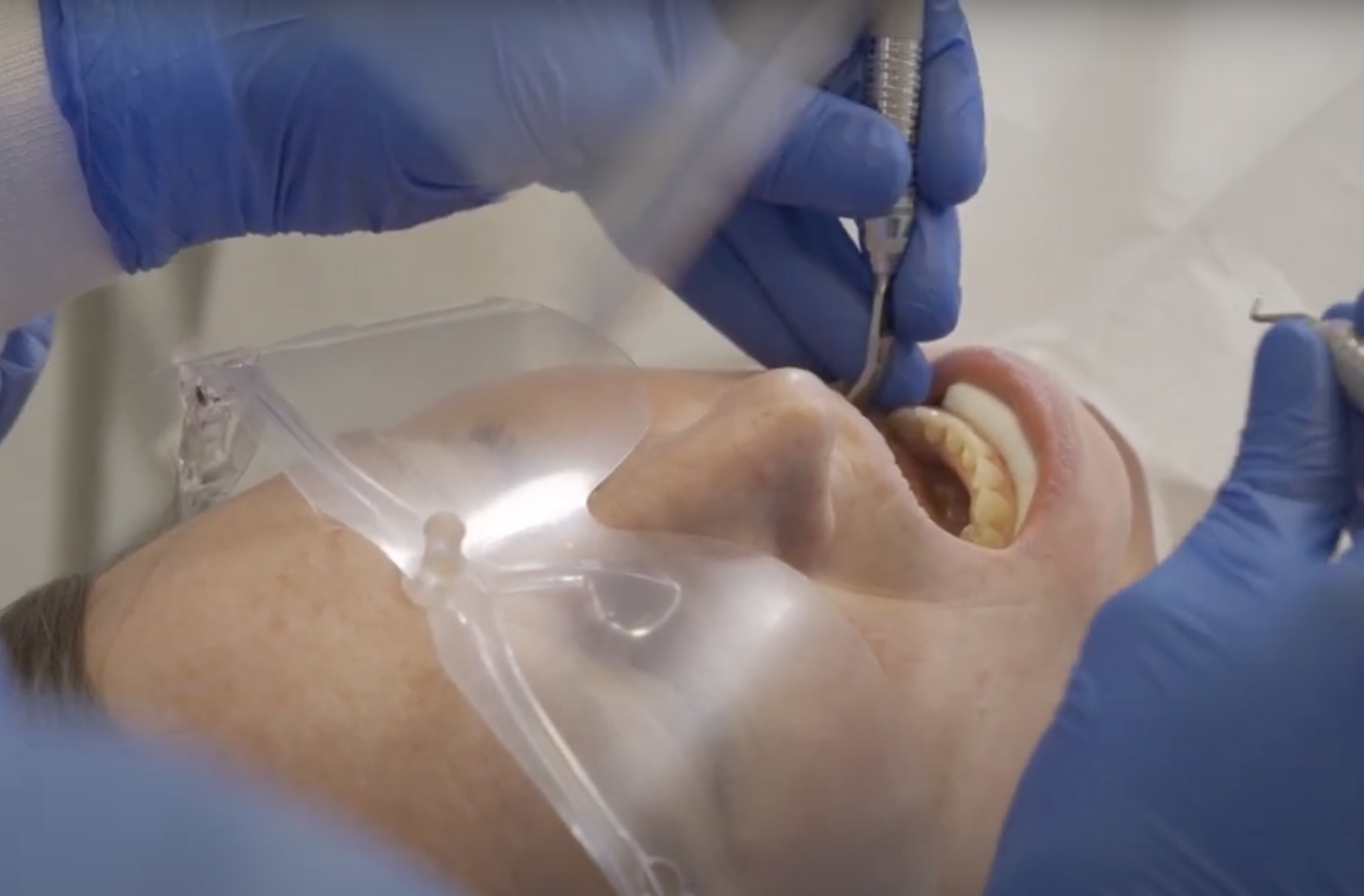 Handhabung Universalscaler