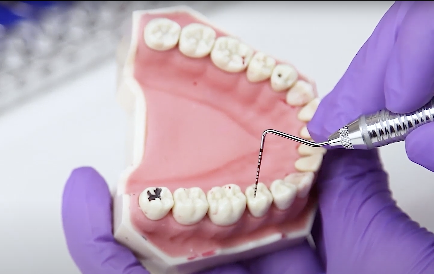 6-Punkt-Messung mit Paradontometer