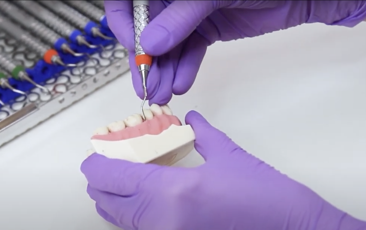 Anwendung der 15/16 Gracey Kürette