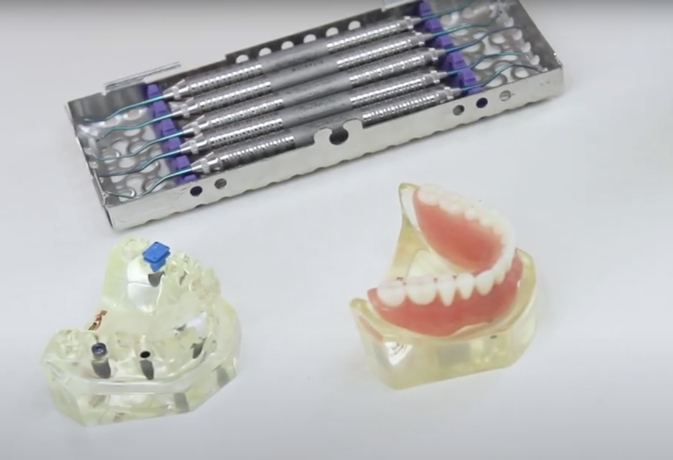 Anwendung von Titan Scaler und Küretten